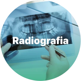 radiografia